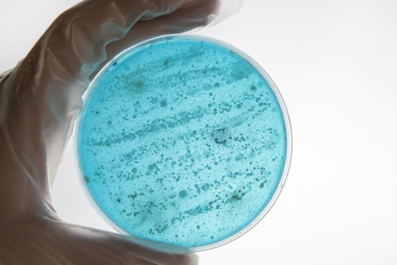 hand with glove holding petri dish with pathogens